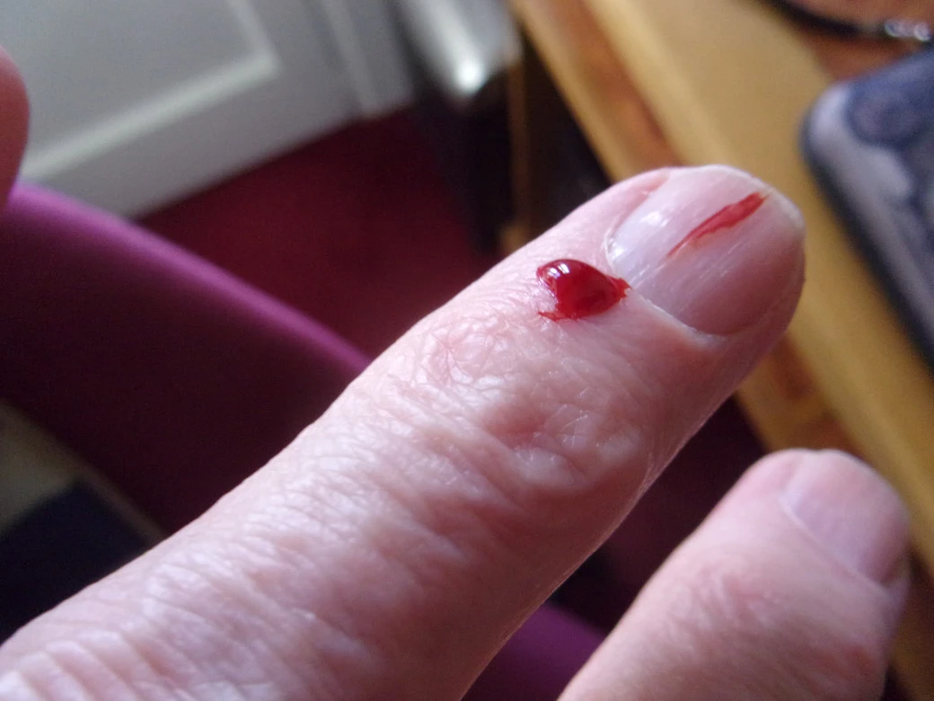 Bitten_0001.webp