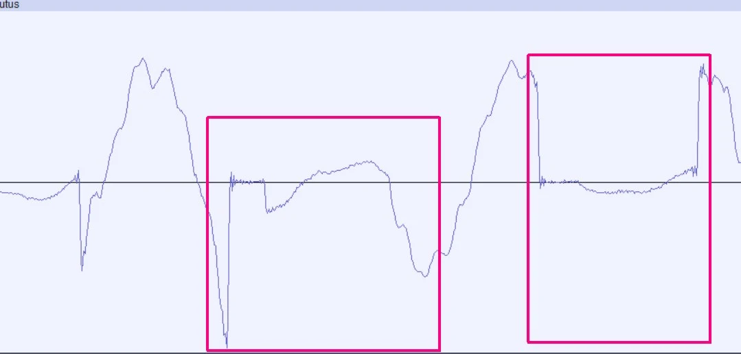 Plautus Overload.webp