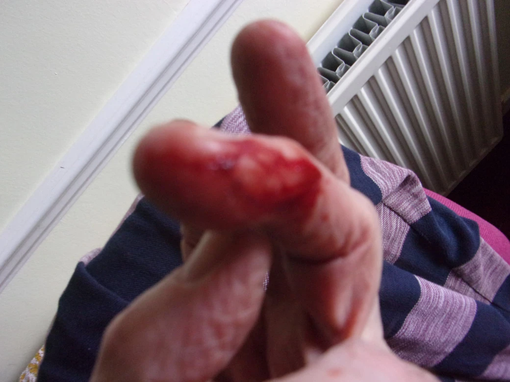 Yeti bite_0001.webp