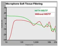 MSTF chart.webp