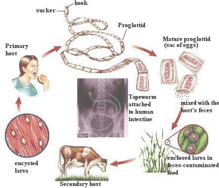 I10-82-tapeworm.jpg